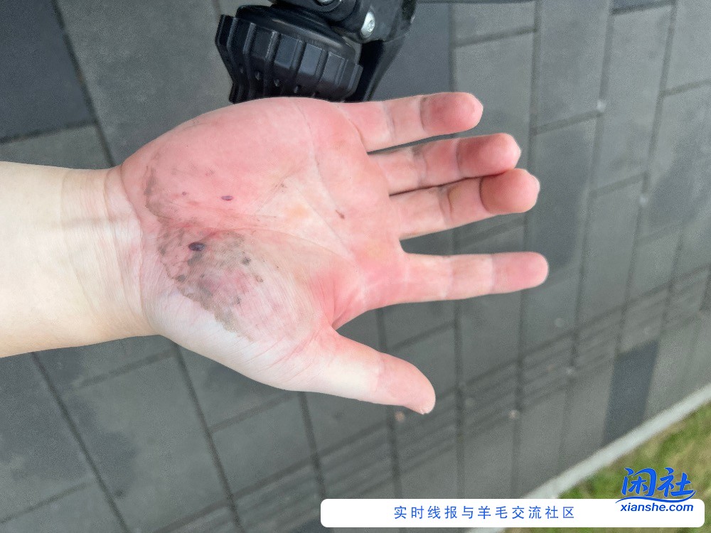 出车祸了