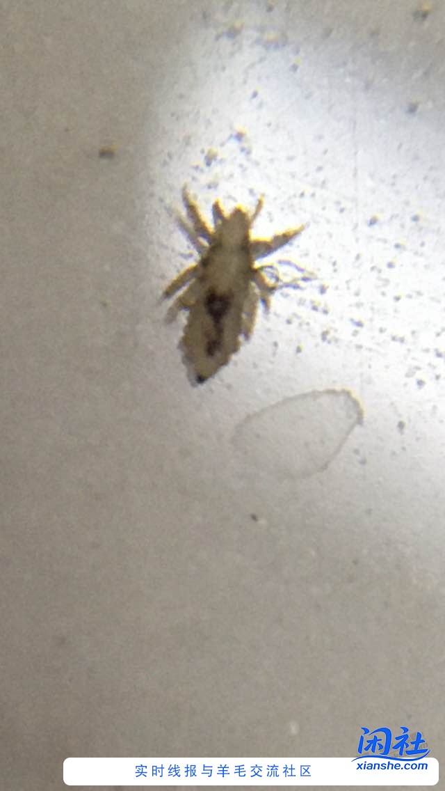 this is头虱
