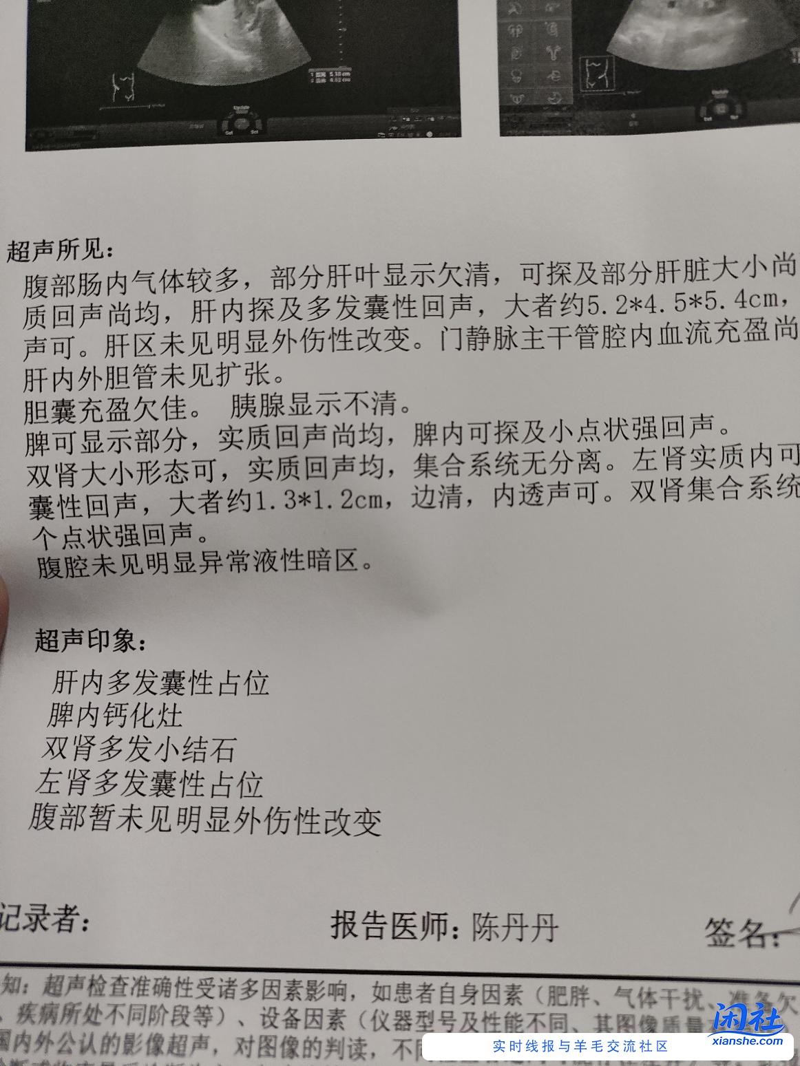 吧医来看看这张彩超单子诊断的啥结果？